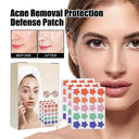 Acne Scar Prevention Hydrocolloid Patches For Fast Recovery Acne Scar Prevention Hydrocolloid Patches For Fast Recovery