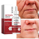Original Remove Wrinkle Face Set Anti-Aging Serum Eye Stick Original Remove Wrinkle Face Set Anti-Aging Serum Eye Stick