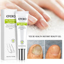 EFERO Nail Fungus Repair Serum Combat Infections Nourish Nails EFERO Nail Fungus Repair Serum Combat Infections Nourish Nails