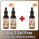Hair Growth Oil: Rapid Repair for Baldness and Loss Hair Growth Oil: Rapid Repair for Baldness and Loss