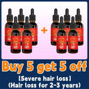 Hair Growth Oil Rapidly Regrow Hair and Combat Baldness Hair Growth Oil Rapidly Regrow Hair and Combat Baldness