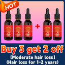 Hair Growth Oil Rapidly Regrow Hair and Combat Baldness Hair Growth Oil Rapidly Regrow Hair and Combat Baldness