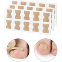 Ingrown Toenail Corrector Stickers Healthy Nail Care Solution Ingrown Toenail Corrector Stickers Healthy Nail Care Solution