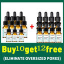 Pore Minimizing Serum: Achieve Flawless Radiance Today Pore Minimizing Serum: Achieve Flawless Radiance Today