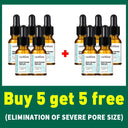 Pore Minimizing Serum: Achieve Flawless Radiance Today Pore Minimizing Serum: Achieve Flawless Radiance Today