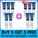 Spotless Complexion Dark Spot Remover Cream for Melasma Spotless Complexion Dark Spot Remover Cream for Melasma