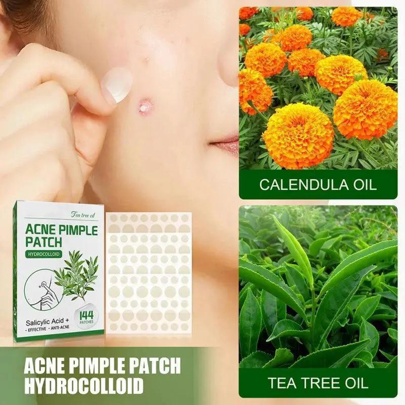 Overnight Acne Patches With Salicylic Acid For Clearer Skin