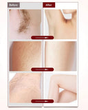 2-in-1 Epilator for Women Face and Body