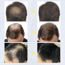 Hair Thickening Fibers for Thinning Hair