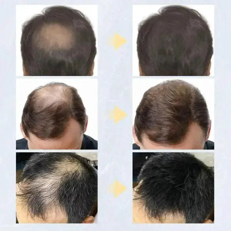 9 Shades Hair Thickening Fibers for Instant Volume Boost