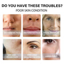 EELHOE Protein Lifting Thread Kit Anti Aging Firming Serum