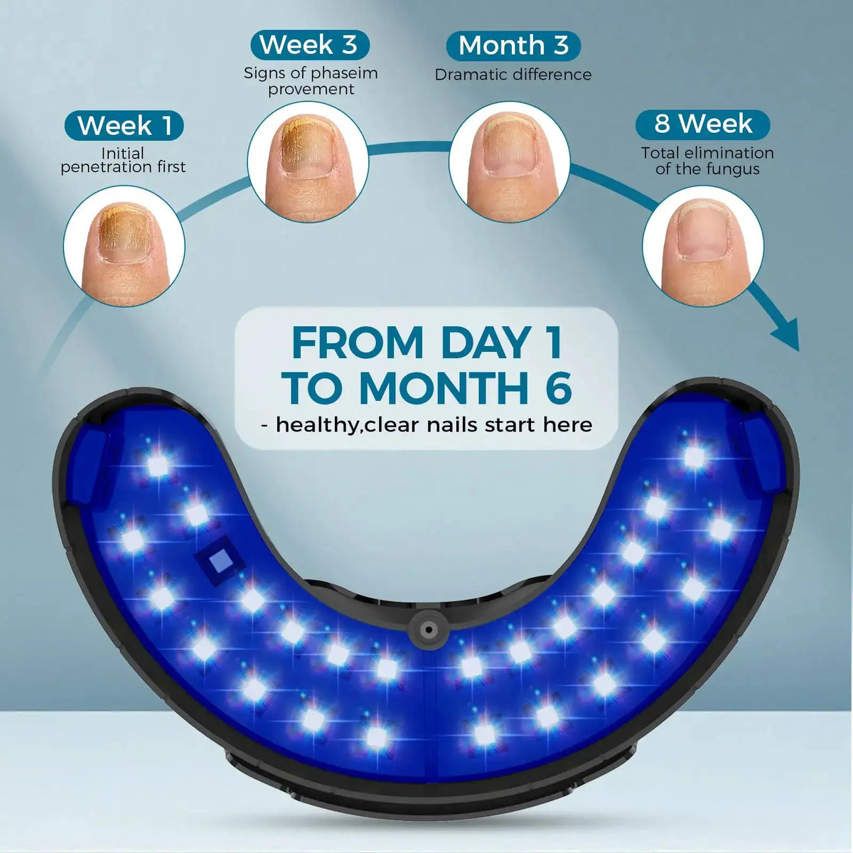 Nail Fungus Treatment LED Light Device Infrared Phototherapy — product view 4