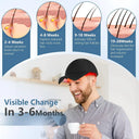 LED Red Light Therapy Hair