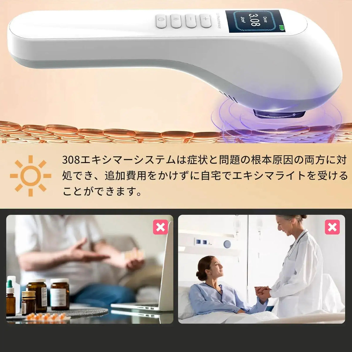 UV Light for Vitiligo Handheld UVB Phototherapy Lamp with LCD — product view 2