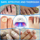 Nail Fungus Treatment LED Light Therapy Device Beads Red Light