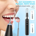 Ultrasonic Personal Dental Cleaning Cleaner Tartar Teeth Stain