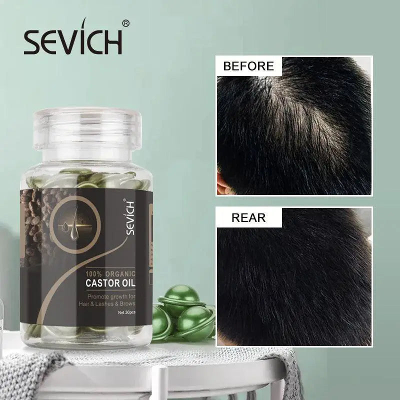 Ginger Hair Repair Capsules For Natural Thickness Growth