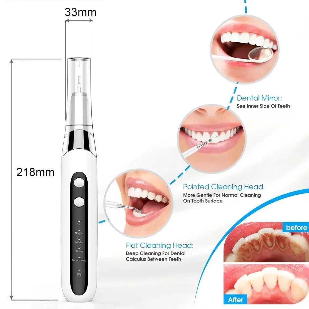 Ultrasonic Dental Cleaner Tartar Teeth Stain Remover