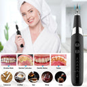 Ultrasonic Personal Dental Cleaning Cleaner Tartar Teeth Stain