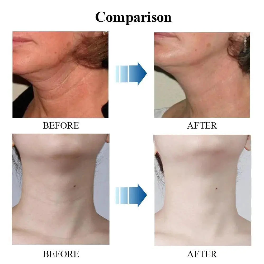 Anti-Wrinkle Retinol Neck Cream Ultimate Firming Solution