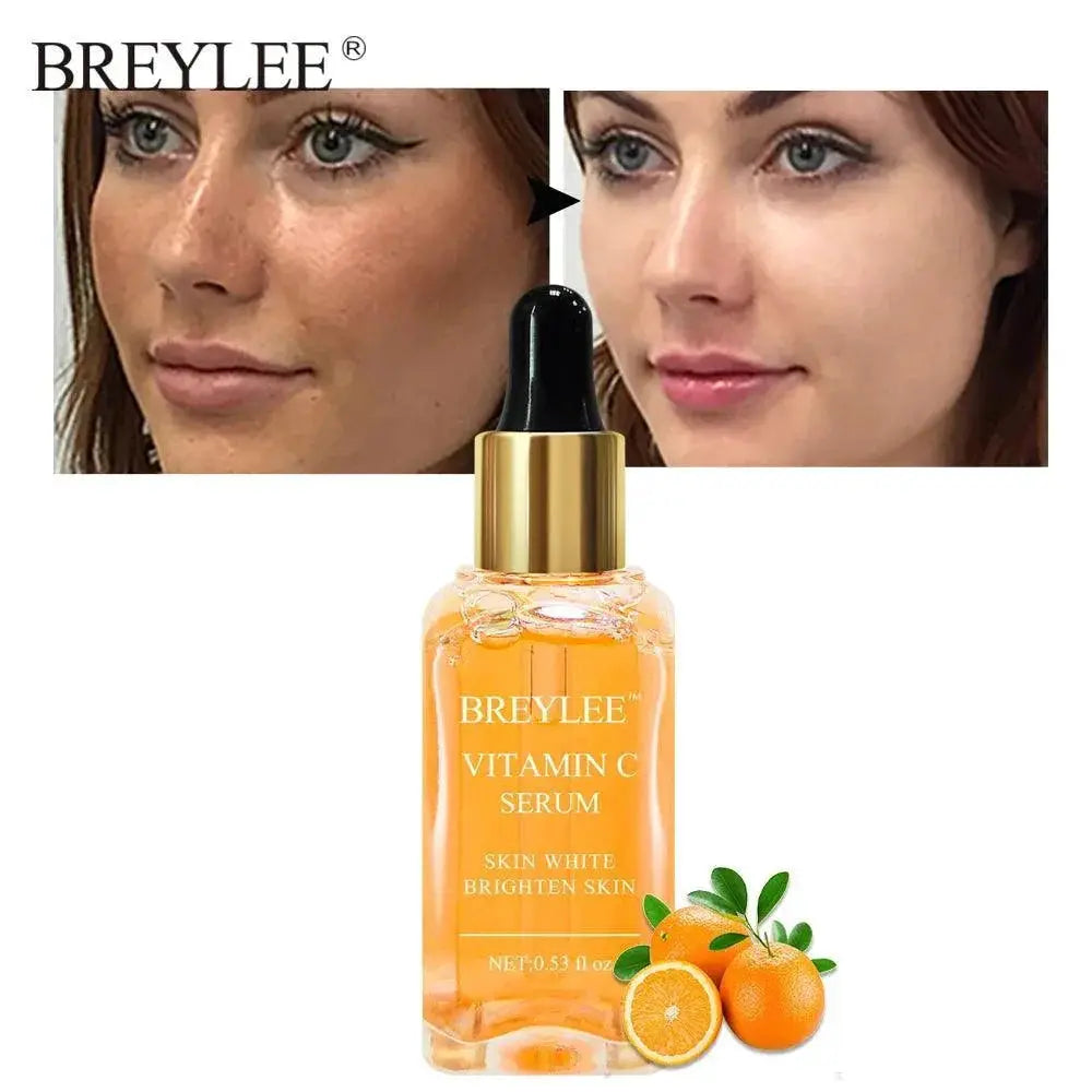 Radiant Glow Vitamin C Serum Brightening Dark Spot Solution