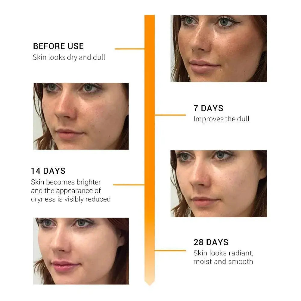 Radiant Glow Vitamin C Serum Brightening Dark Spot Solution