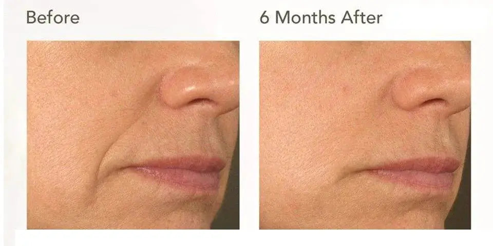 Radiant Glow Serum for Pore Care Daily — product view 11