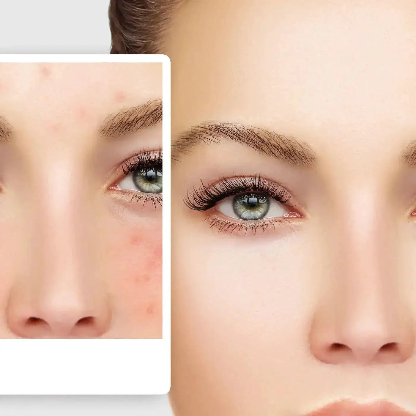 Aloe Vera Gel Healing Moisturizer For All Skin Types