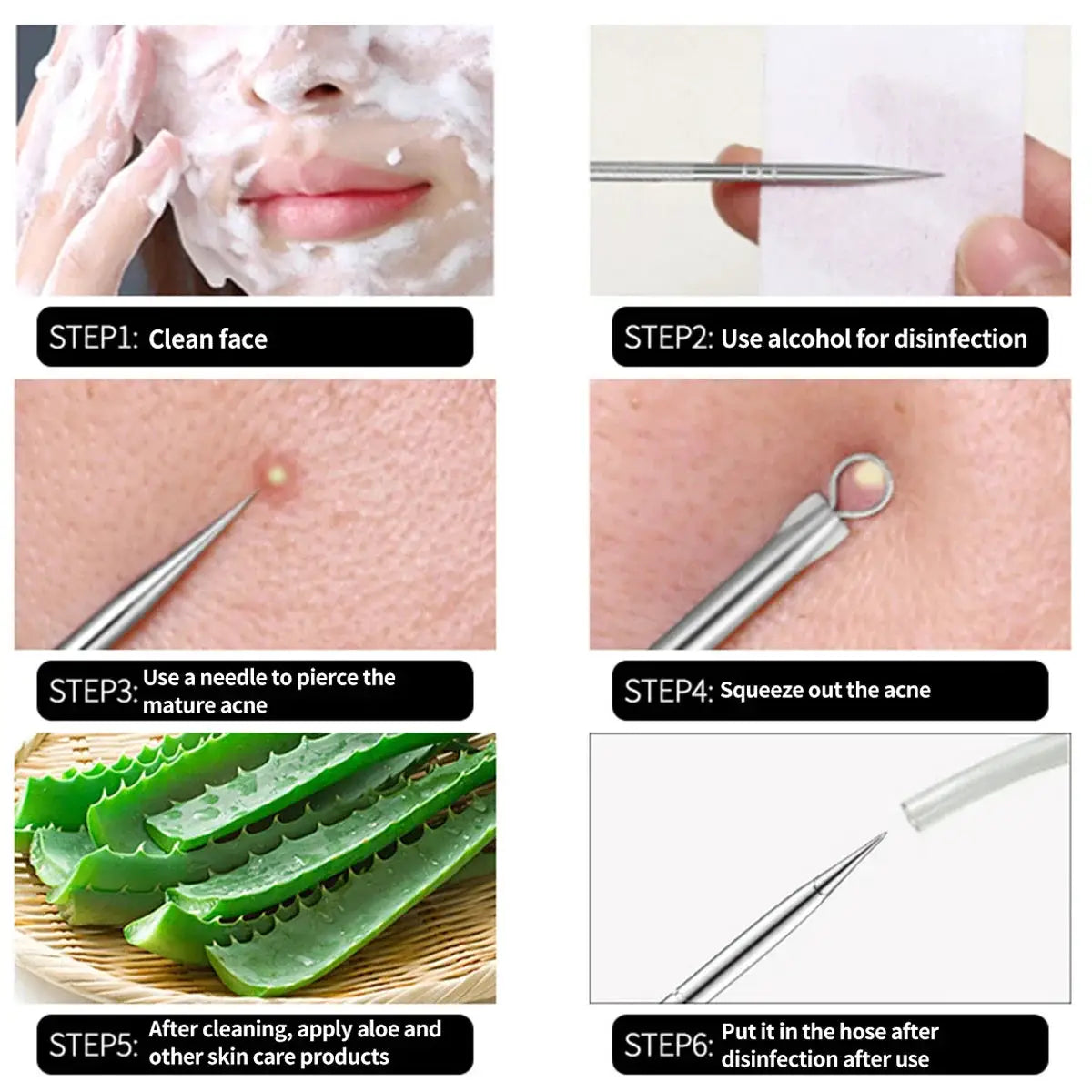 Acne Needle Blackhead Remover Set 4pcs Comedone Kit