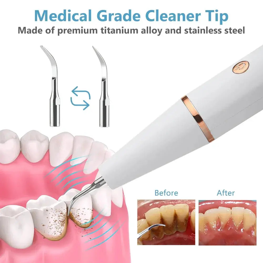 Ultrasonic Teeth Whitening Sonic Cleaning Tool Remover