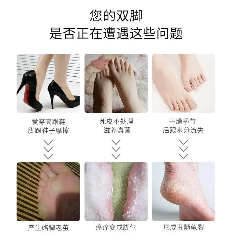 Household Electric Pedicure Tool For Calluses And Dead Skin
