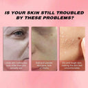 Deep Hydration Jelly Cream for All Skin