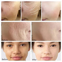 Anti Aging Cream For Mature Skin Lifts