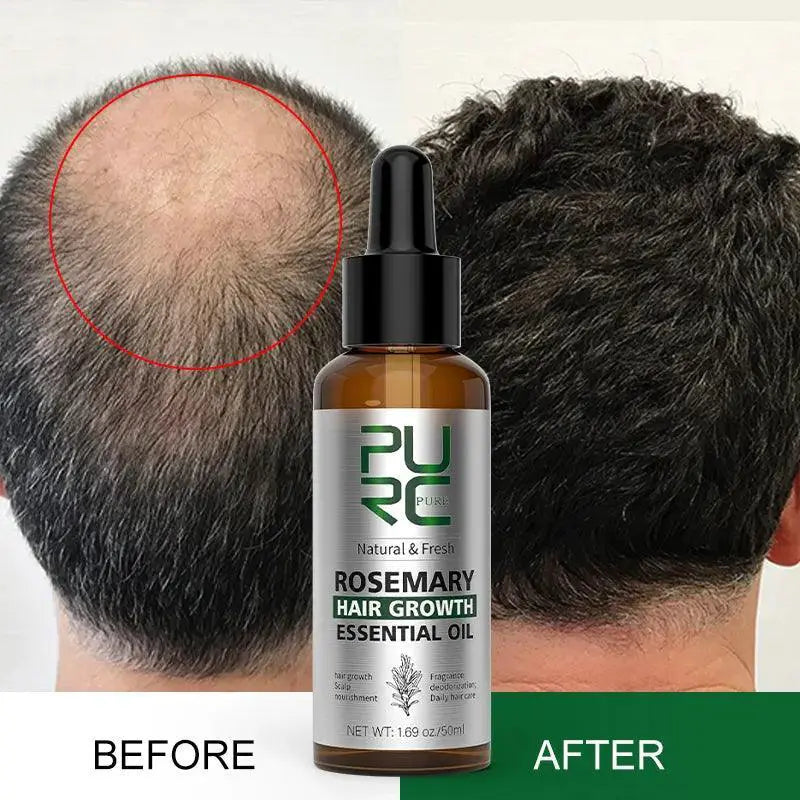Rosemary Oil Hair Growth Elixir For Thicker Stronger Hair