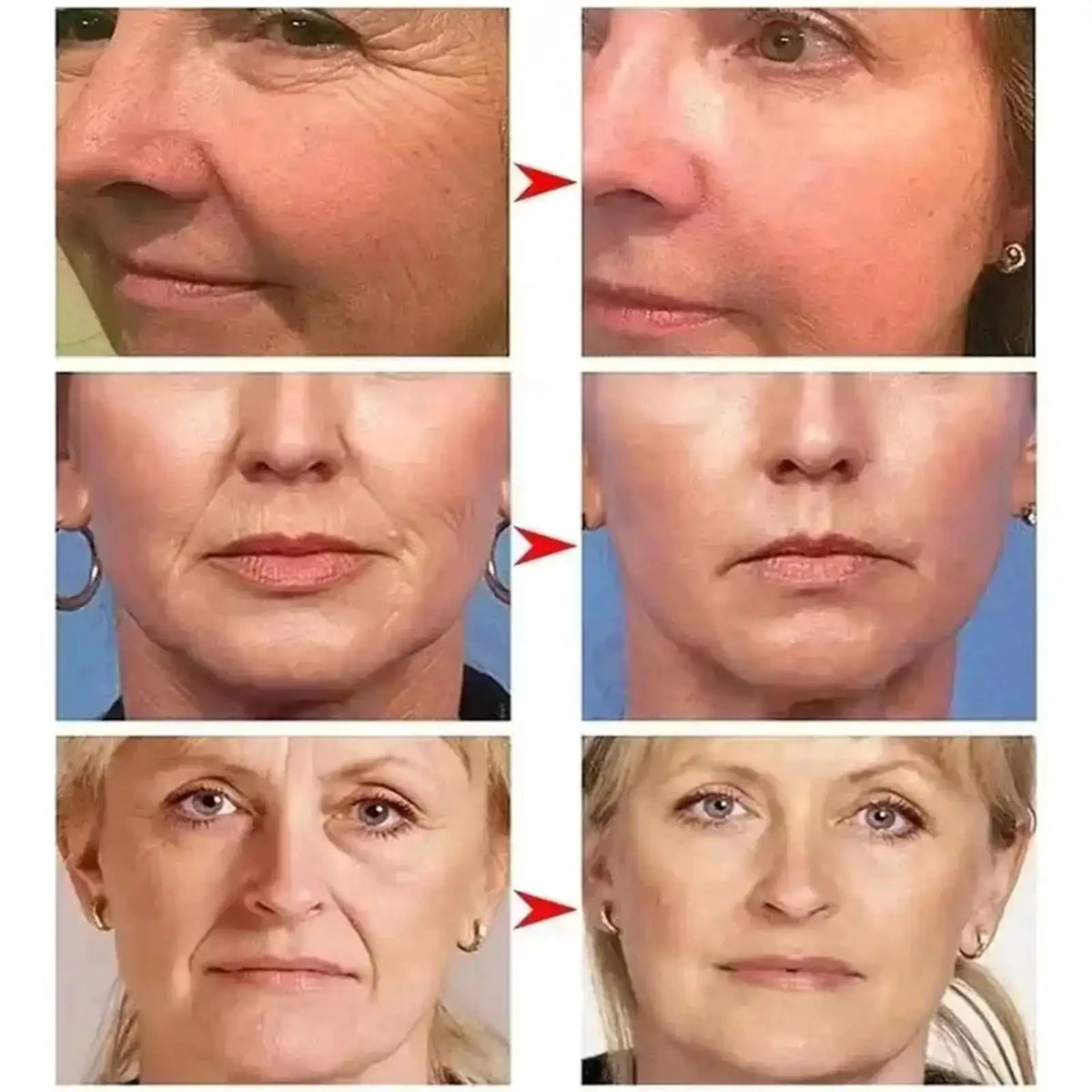 Retinol Anti-wrinkle Cream Collagen Anti-Aging Instant Removal Face Neck Wrinkle Efficient Moisturizing Firming Korean Skin Care