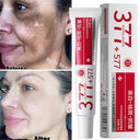 Powerful Spot Removing Whitening Cream for Dark Spots and Melasma