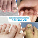 Fungal Nail Treatment Device Blue Light Therapy LEDs Toenail