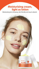 Oil Control Acne Cream for Clear Skin
