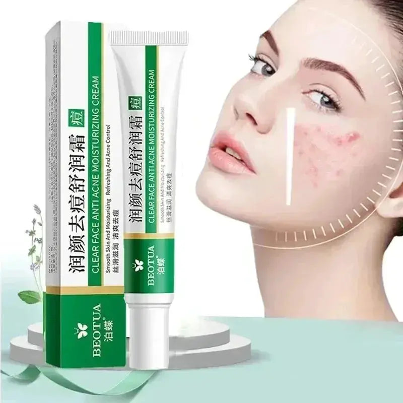 20g Whitening Freckle Cream Remove Dark Spot Cream Anti Freckle and Aging Cream Fade Pigmentation Melasma Brighten Serum Skin