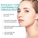 Whitening Freckle Face Cream for Melasma