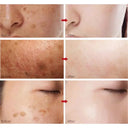 Face Cream for All Skin Brightens Tone
