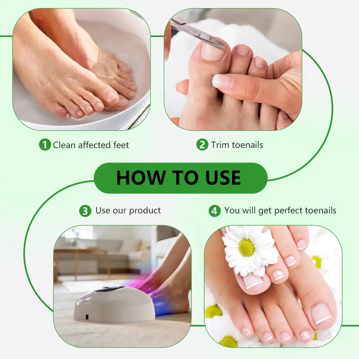 Nail Fungus Treatment Light Device Set Timer Dimming Phototherapy — product view 4