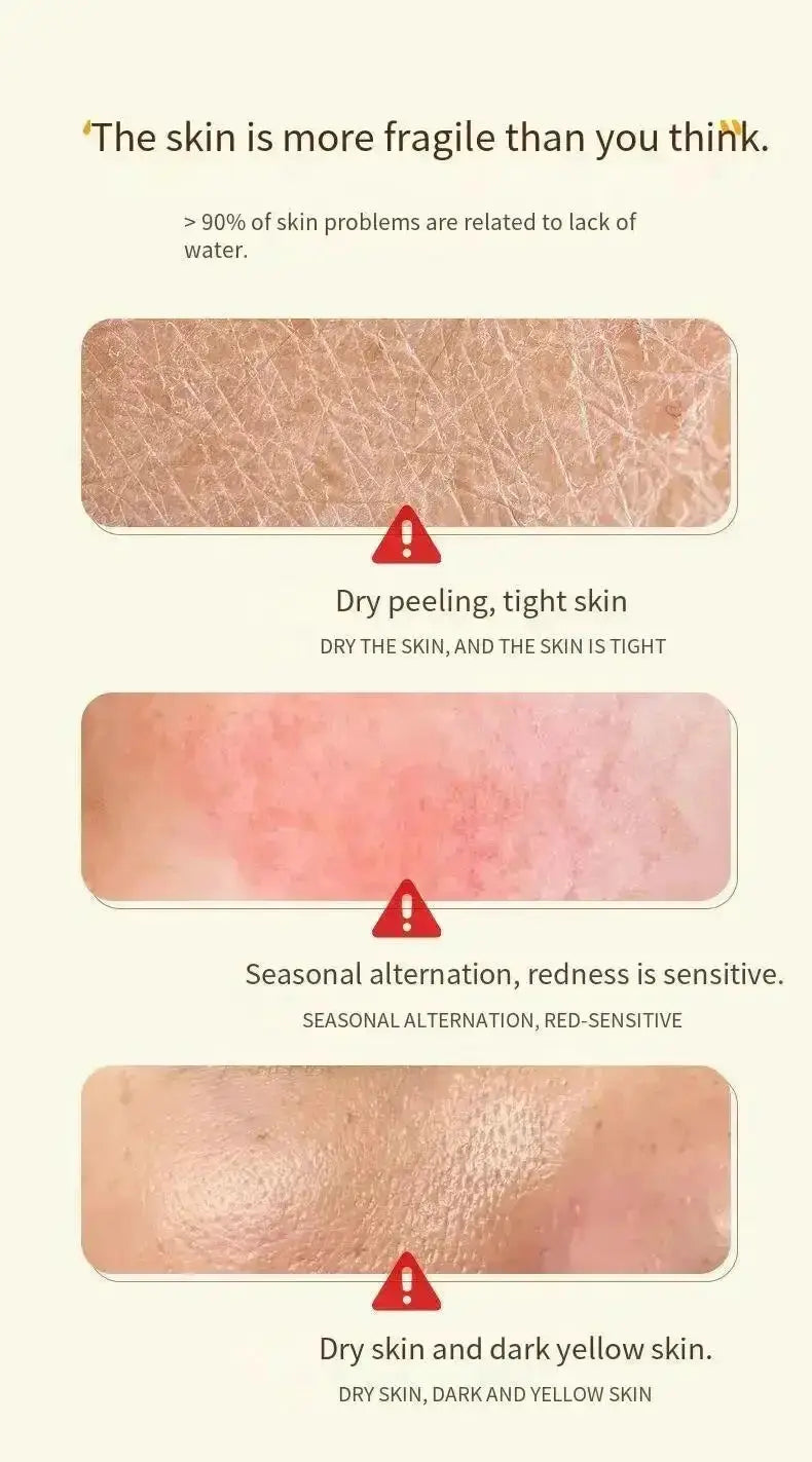 Freckle Cream - Brighter Skin — product view 12