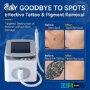 Pico Q Switch Laser Tattoo Remover