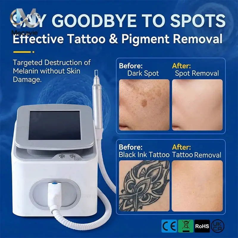 New Portable Pico Picosecond Q-Switch Nd Yag Laser 1064 532 1320 755nm Carbon Laser Peeling Tattoo Beauty Machine for Salon Home