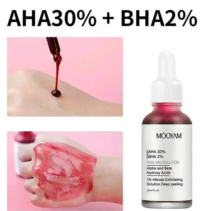 New Face Peeling Solution AHA 30 Percent BHA 2 Percent Serum