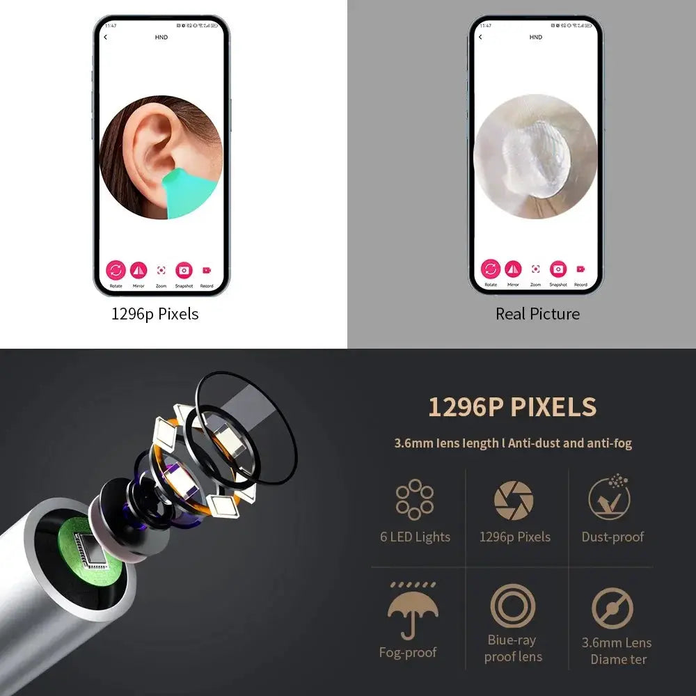 Smart Visual Ear Cleaner With Camera 1296P USB C Earpick