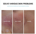 Calming Hydration Cream for Redness