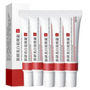 Brightening Freckle Cream for Dark Spots