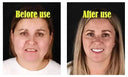 Jawline Lift Cream for Women and Men